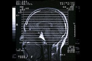 ホワイトニングに特化した歯医者です